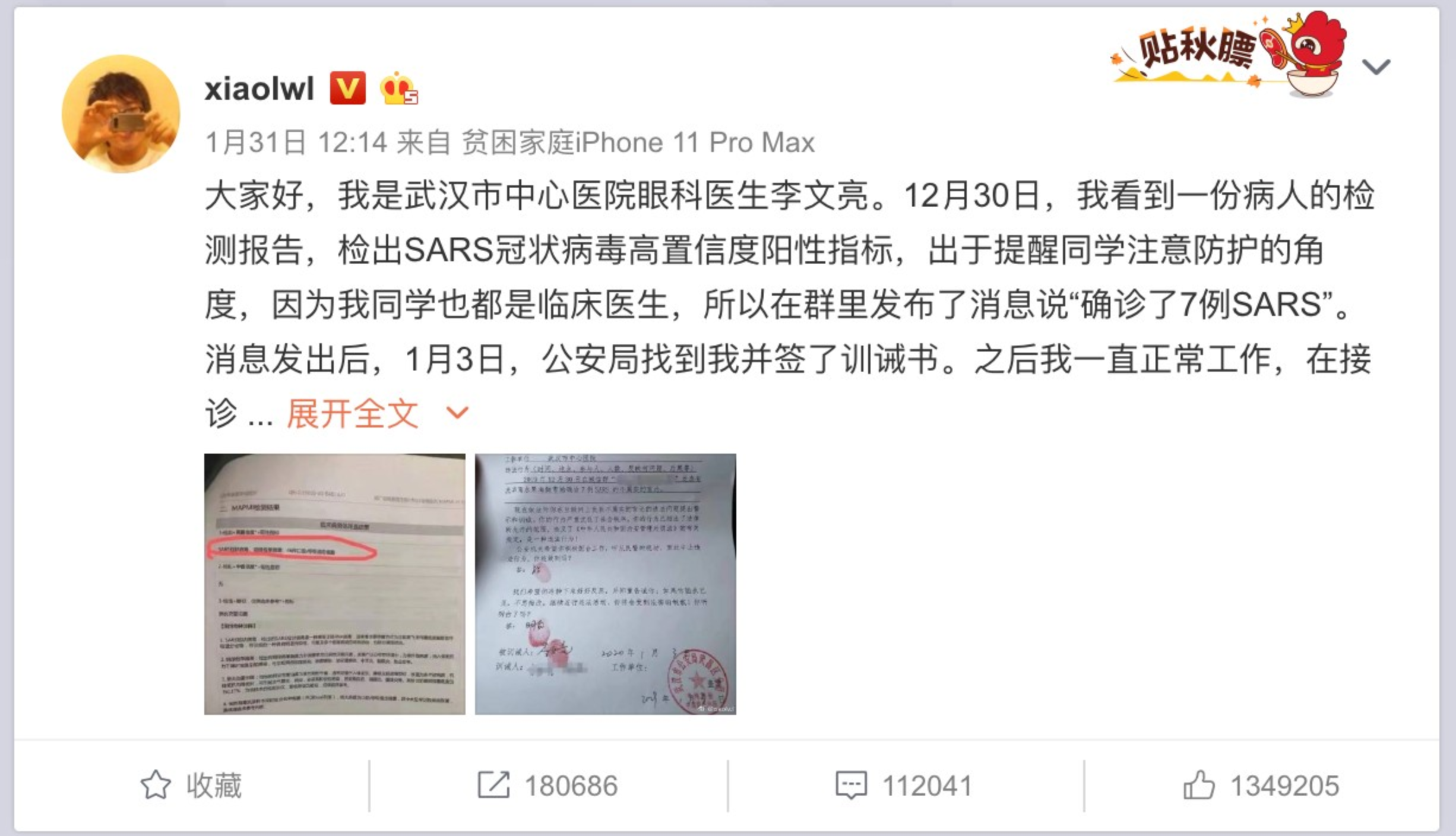 最早公開疫情“吹哨人”李文亮去世