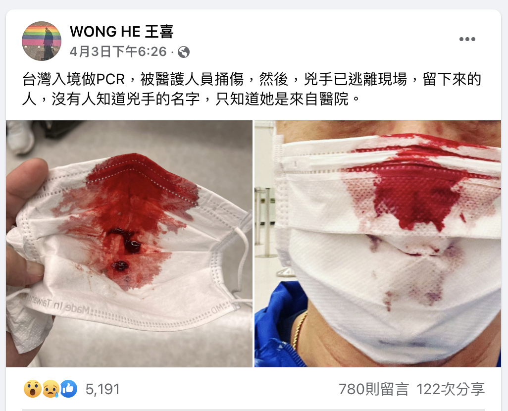 香港明星王喜 陽性仍帶著染血口罩 在台拍片打卡
