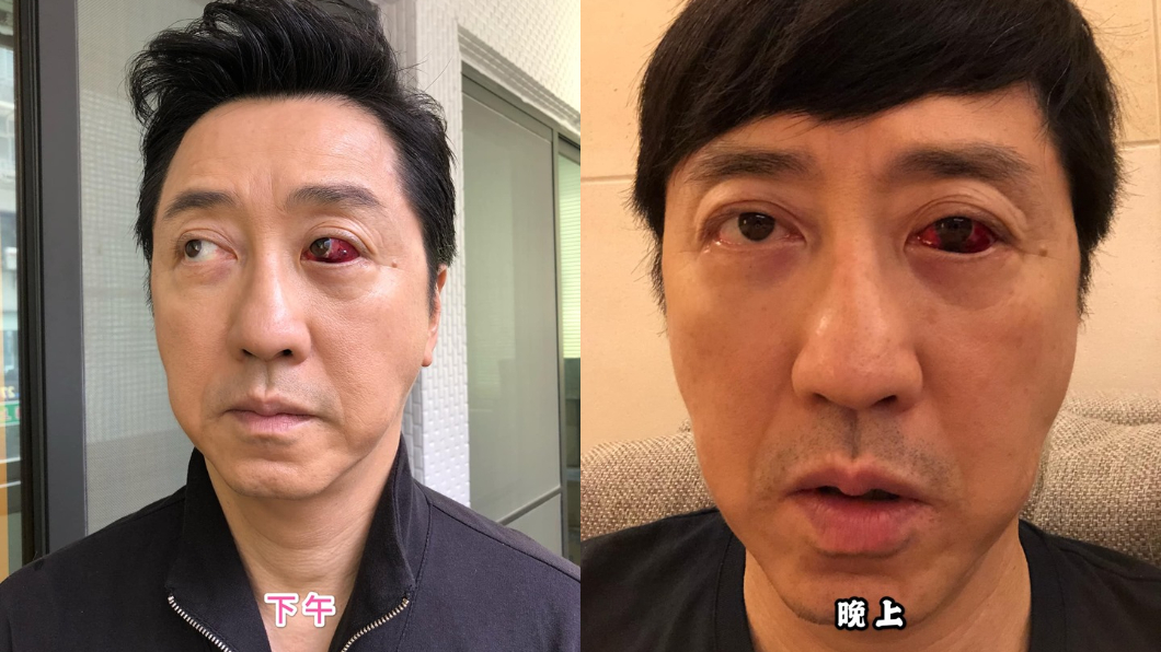 網傳庾澄慶突發心臟病去世