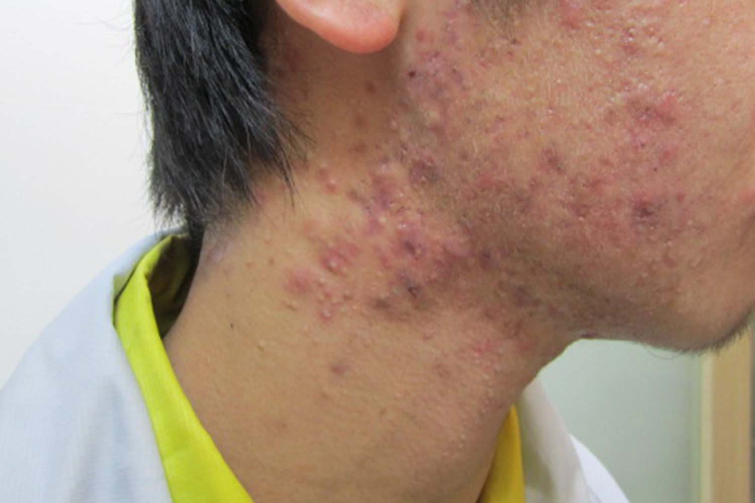 肺部有癌，雙腳先知？同時出現 4 現象，癌症或已到了中晚期