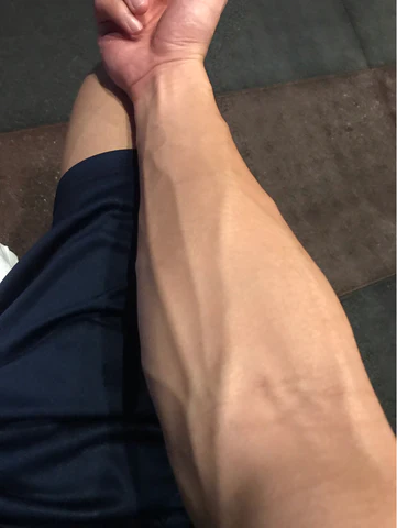青筋多的人，身體更好嗎？