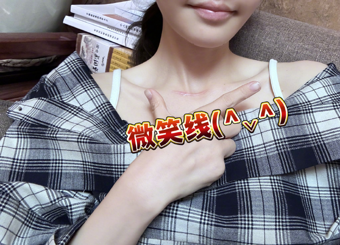 馮提莫驚爆罹 甲狀腺癌末期
