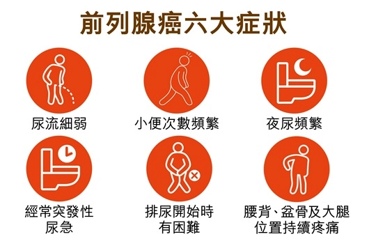 出現 4 異常，小心前列腺癌晚期