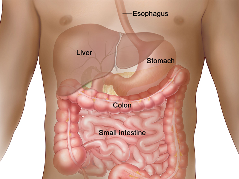 連環屁不斷,小心是大腸癌 連環屁不斷,小心是大腸癌