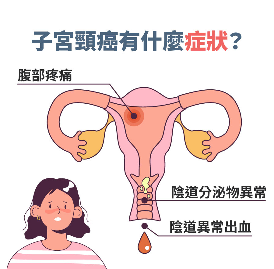務必小心！你可能不知道的子宮頸癌症狀！