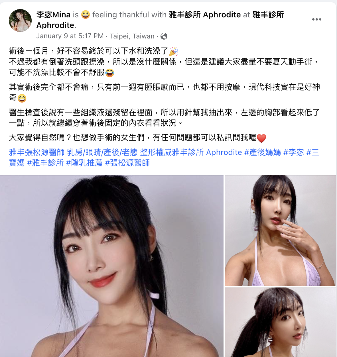 富二代女藝人，第 3 次隆胸隆 G 罩杯曝光