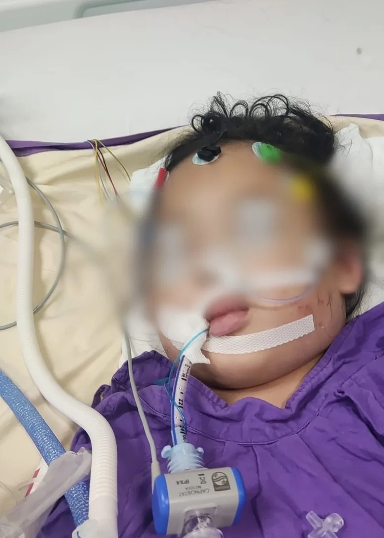 父親控仁濟醫院失職，4 歲女童縫針後心臟停頓、陷入昏迷