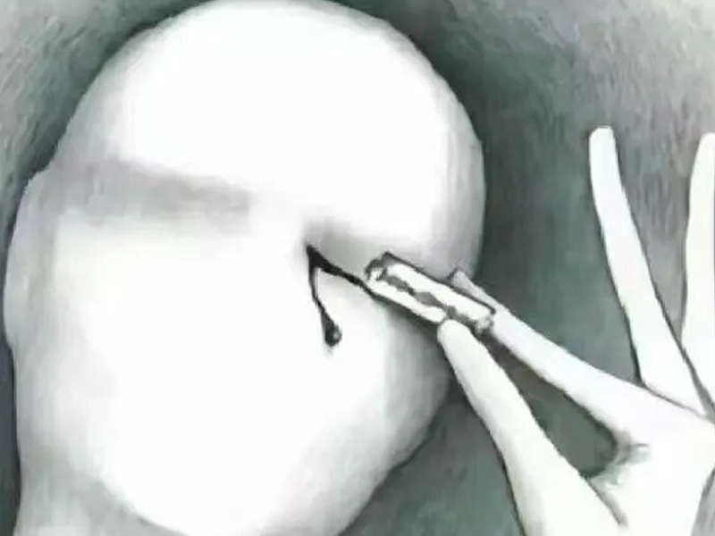 療癒內心創傷,告別無止境的胡思亂想 療癒內心創傷,告別無止境的胡思亂想