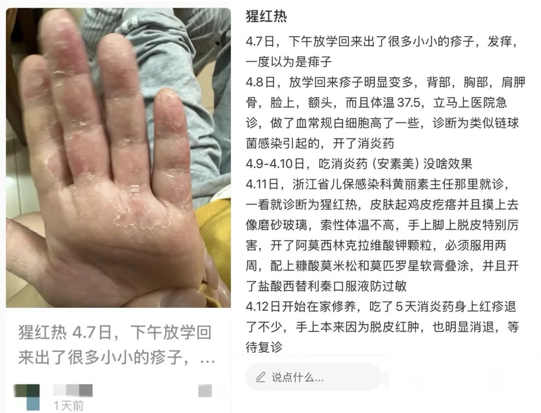 廣東 1542 確診，無疫苗可預防